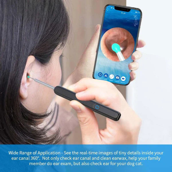 𝘿𝙆 𝙨𝙩𝙤𝙧𝙚 ™Smart Ear Cleaning Device