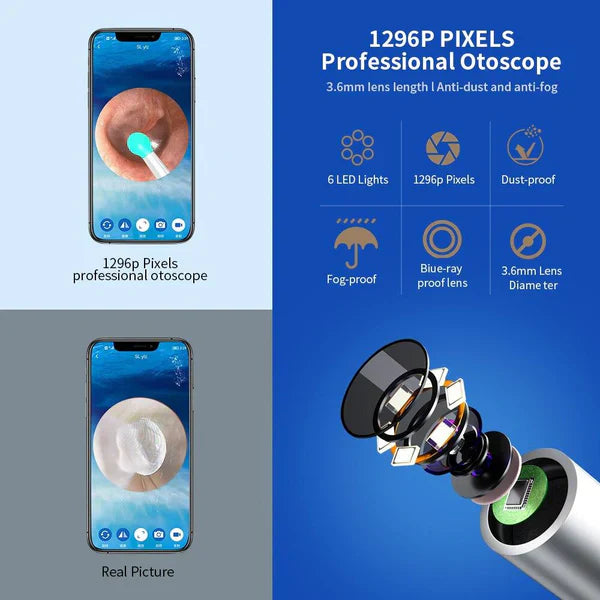 𝘿𝙆 𝙨𝙩𝙤𝙧𝙚 ™Smart Ear Cleaning Device